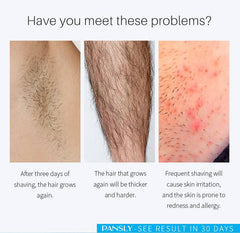 Painless Hair Removal Spray for Face, Arms, and Legs