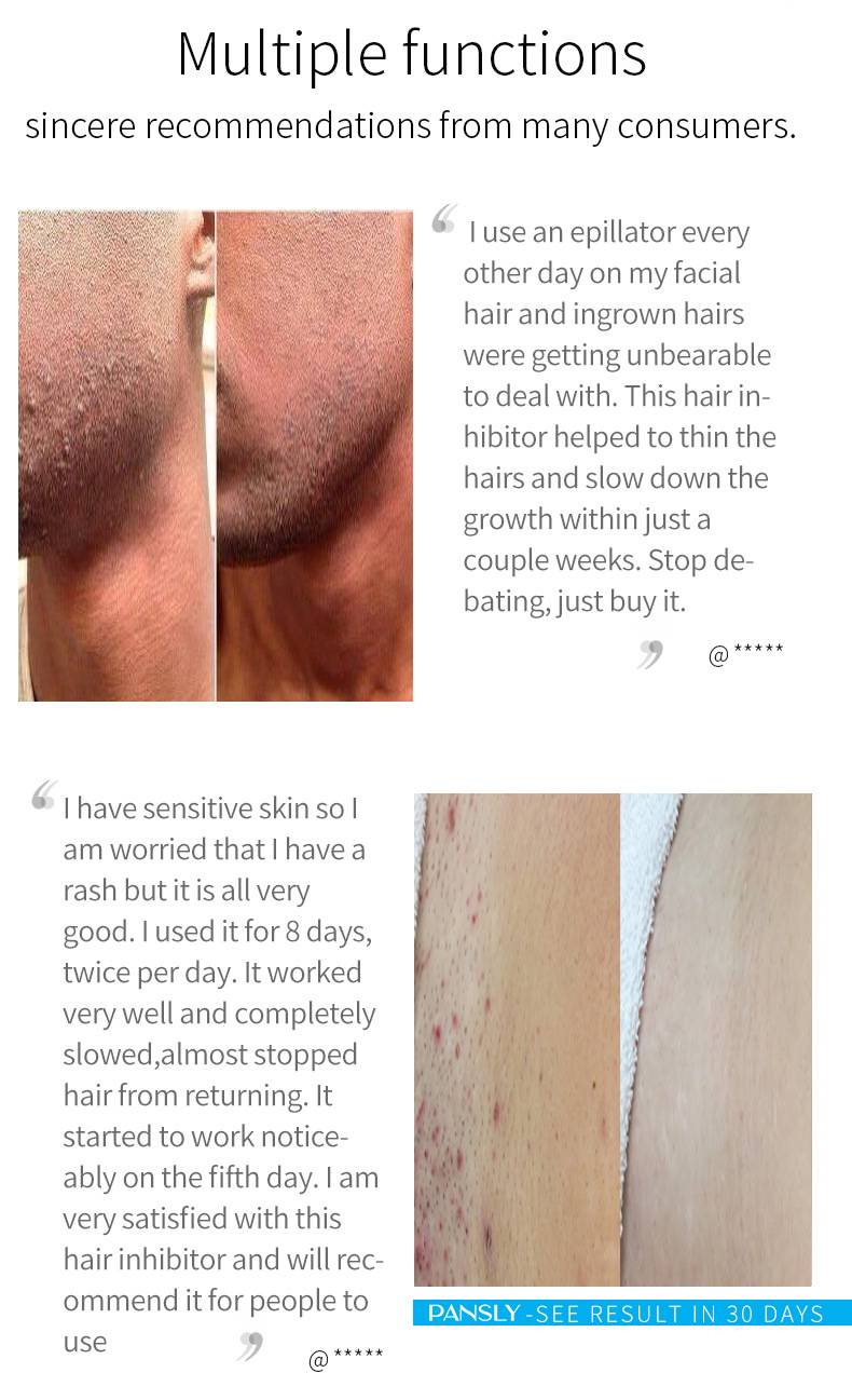 Painless Hair Removal Spray for Face, Arms, and Legs